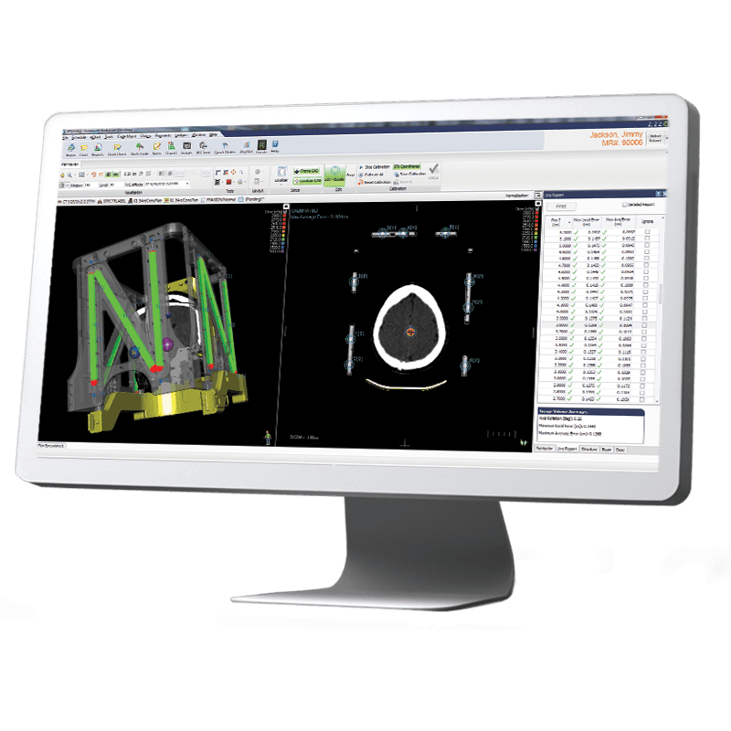 MOSAIQ® Locate