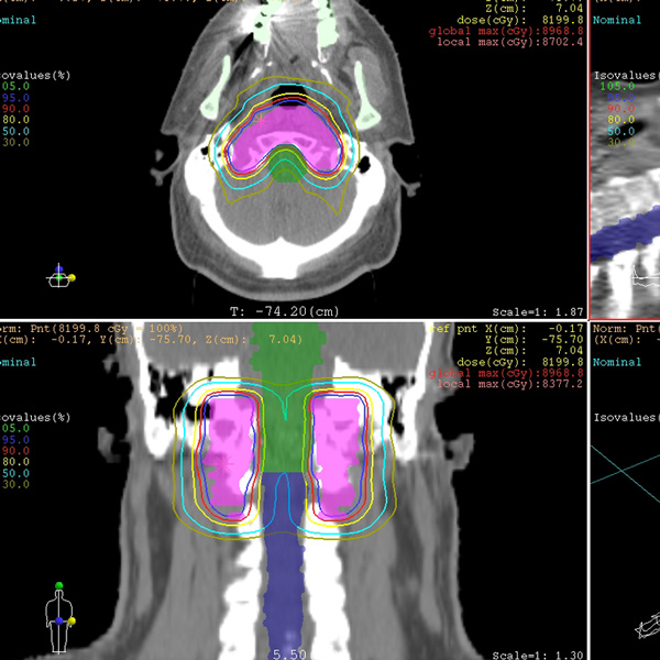 Integrated proton therapy components