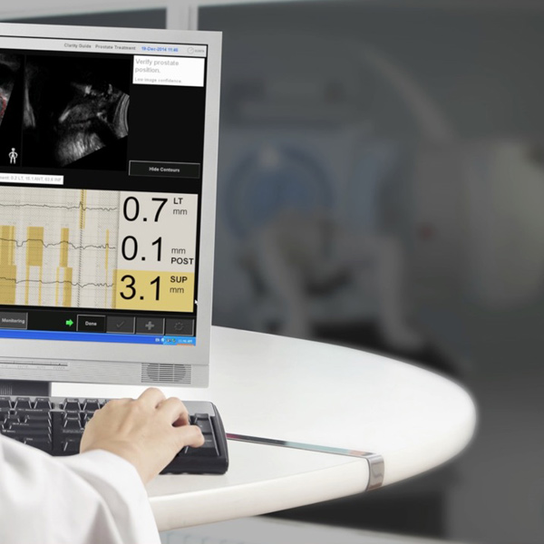 Intra-fraction 4D monitoring for prostate