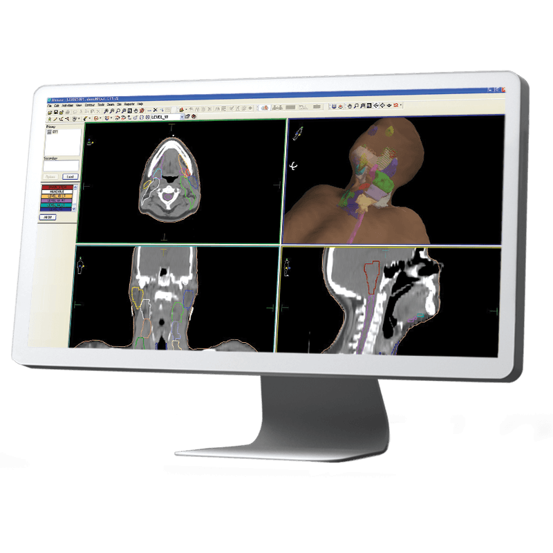 ABAS® Atlas-Based </br>Autosegmentation