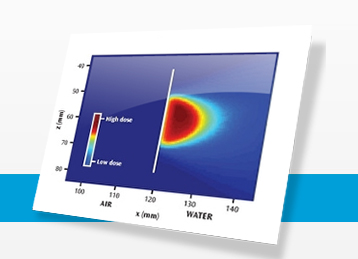 Leksell GammaPlan® -Convolution