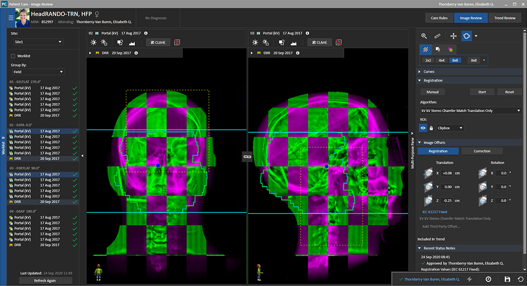 MOSAIQ marks 30th year of easier, safer radiotherapy